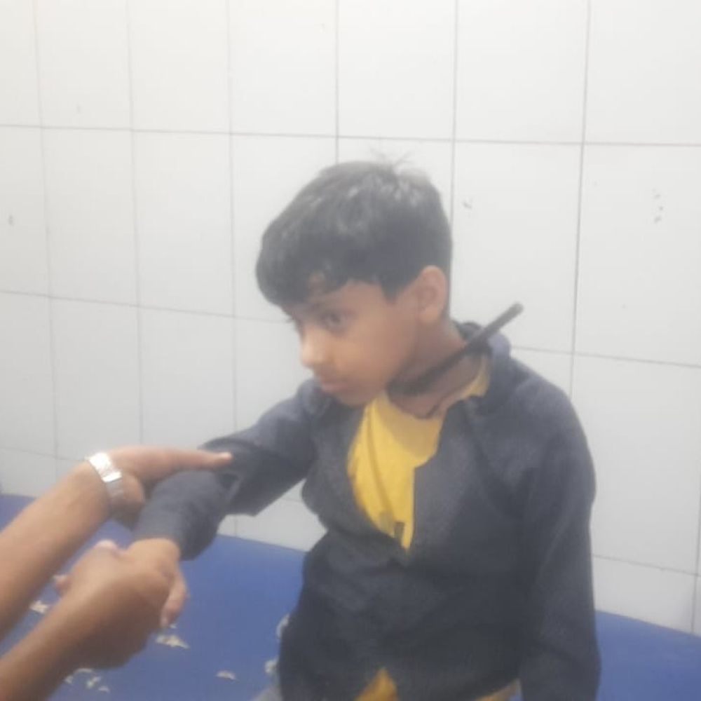 बुलंदशहर में खेलते समय पिलर पर गिरा बच्चा:गले के आरपार हुआ सरिया, हायर सेंटर रेफर