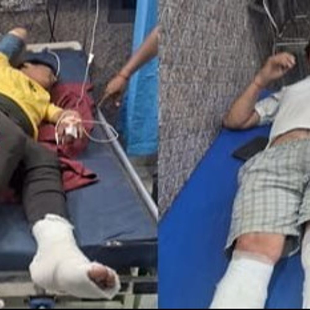 आगरा में दीपक की लौ से घर में लगी आग:गैस लीकेज से हुआ धमाका, छत से कूदी बेटी के टूटे पैर; मां-बेटा समेत 3 झुलसे