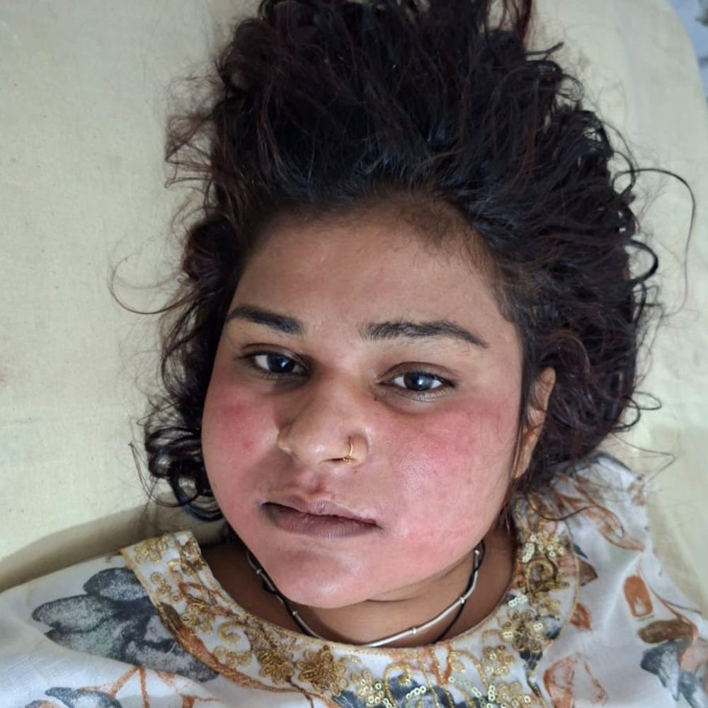 कानपुर मेंम मंदिर विवाद, पुलिस के सामने हमला:महिला समेत कई लोग घायल, पुलिस जांच में जुटी