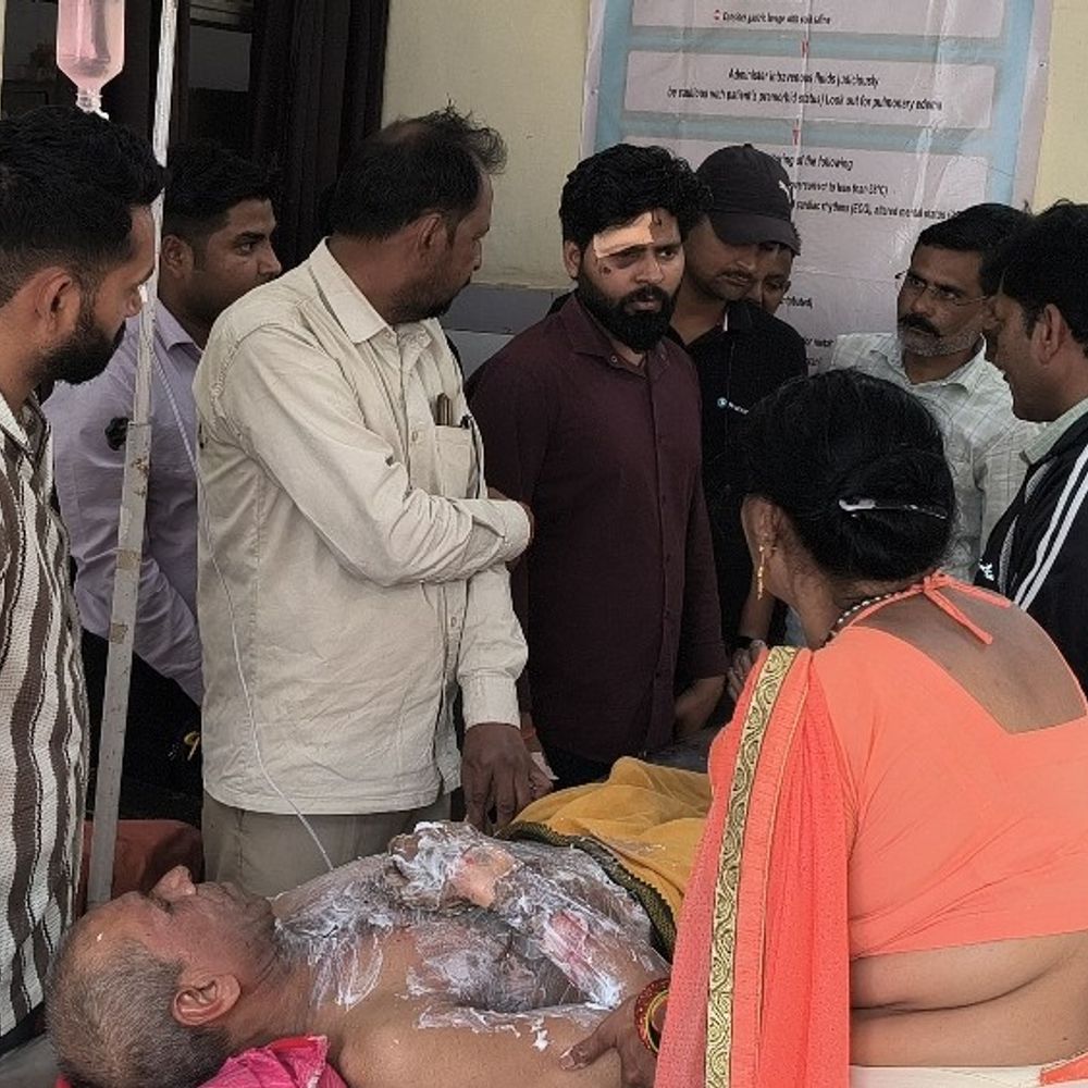 बंदर भगाते समय व्यक्ति हाईटेंशन लाइन की चपेट में आया:एटा में बुरी तरह झुलसा, मेडिकल कॉलेज में भर्ती