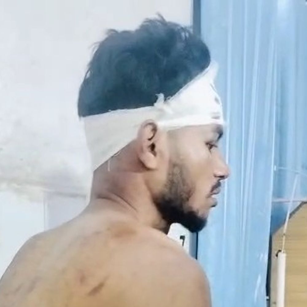 पीलीभीत में दो सगे भाइयों की बेरहमी से पिटाई:पुरानी रंजिश में दूसरे समुदाय के युवकों ने घेरा, मुकदमा दर्ज