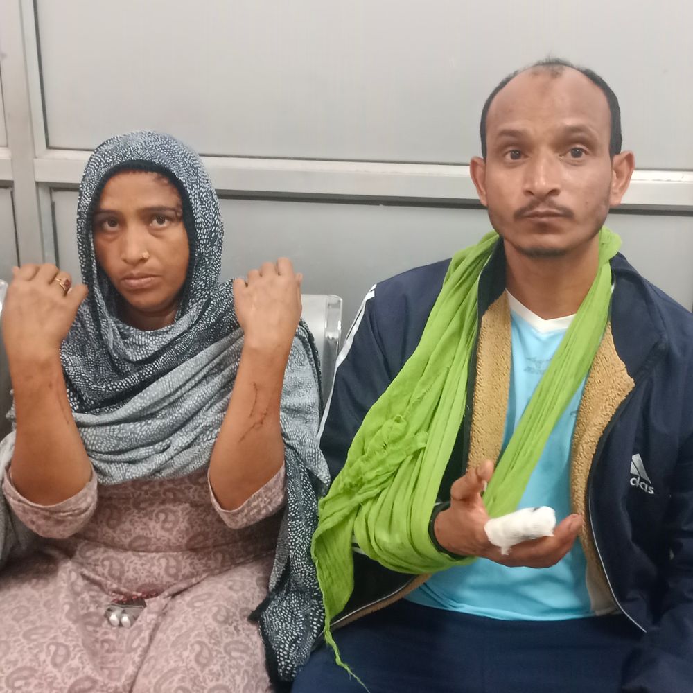 सम्भल में पुरानी रंजिश में दंपती पर चाकू से हमला:कटी उंगली लेकर अस्पताल पहुंचा पीड़ित, लोगों के आने पर फरार हुए आरोपी