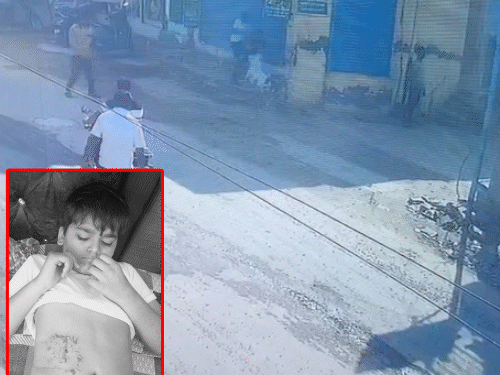 रोहतक में 2 पिटबुल डॉग ने बच्चे को नोचा,VIDEO:  पेट से पकड़ घसीटा, 7 साल का छोटा भाई बचाने को भागा; मामा पास जा रहे थे – Rohtak News