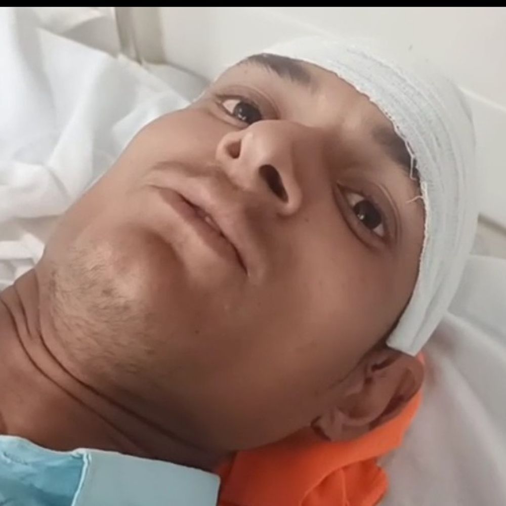 खेत में फसल काट रहे युवक पर बंदर का हमला:शोर मचाने पर भागा बंदर, युवक का जिला अस्पताल में इलाज जारी