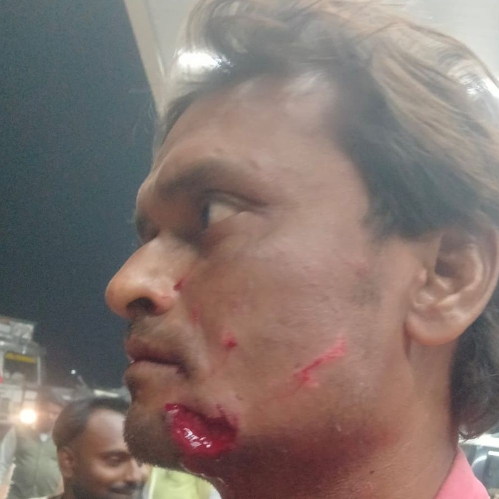 बलरामपुर में पेट्रोल पंप पर मारपीट, युवक की पिटाई:जबरन पेट्रोल भरवाने को लेकर हुआ विवाद, VIDEO आया सामने