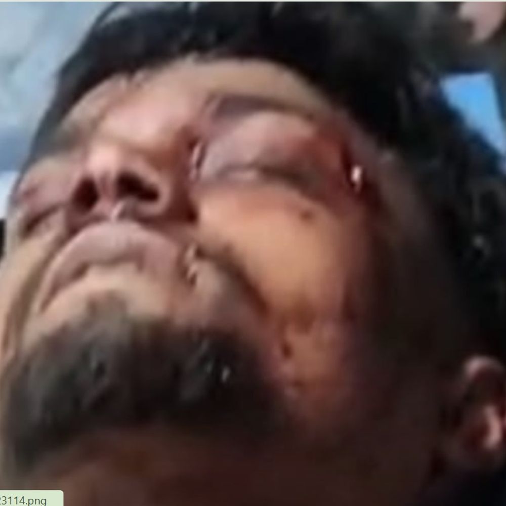 जालंधर के शहीद बाबू लाभ सिंह नगर में गुंडागर्दी:  सरेआम फायरिंग के बाद युवक पर तेजधार हथियारों से जानलेवा हमला, आरोपी फरार – Jalandhar News