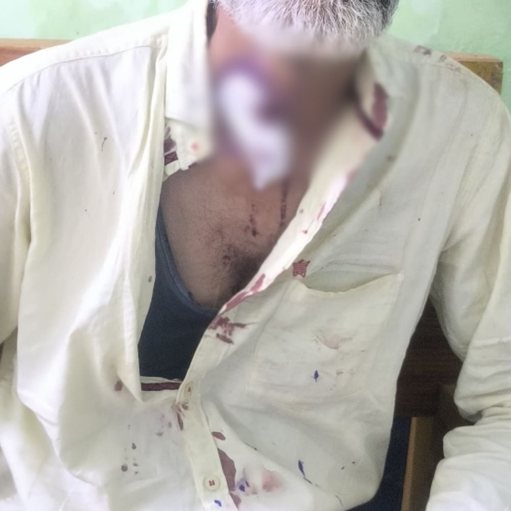 गाली देने से मना किया,पड़ोसी ने हंसिया से काटा गला:  बलौदाबाजार में युवक गंभीर घायल, डॉक्टर ने चोट को बताया गंभीर – baloda bazar News