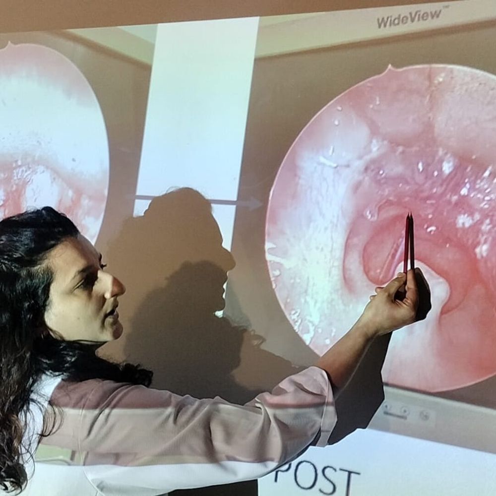 मैक्स हॉस्पिटल में 2 महीने की बच्ची को नई जिंदगी,:जन्म से सांस की नली में गंभीर रुकावट का सफल इलाज, मल्टीडिसिप्लिनरी टीम और आधुनिक तकनीक से बची जान