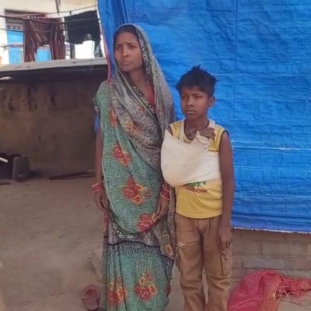 बच्चे का हाथ टूटा, डॉक्टर ने पीठ तक प्लास्टर चढ़ाया:उन्नाव के निजी अस्पताल पर लापरवाही का आरोप, वीडियो आया सामने