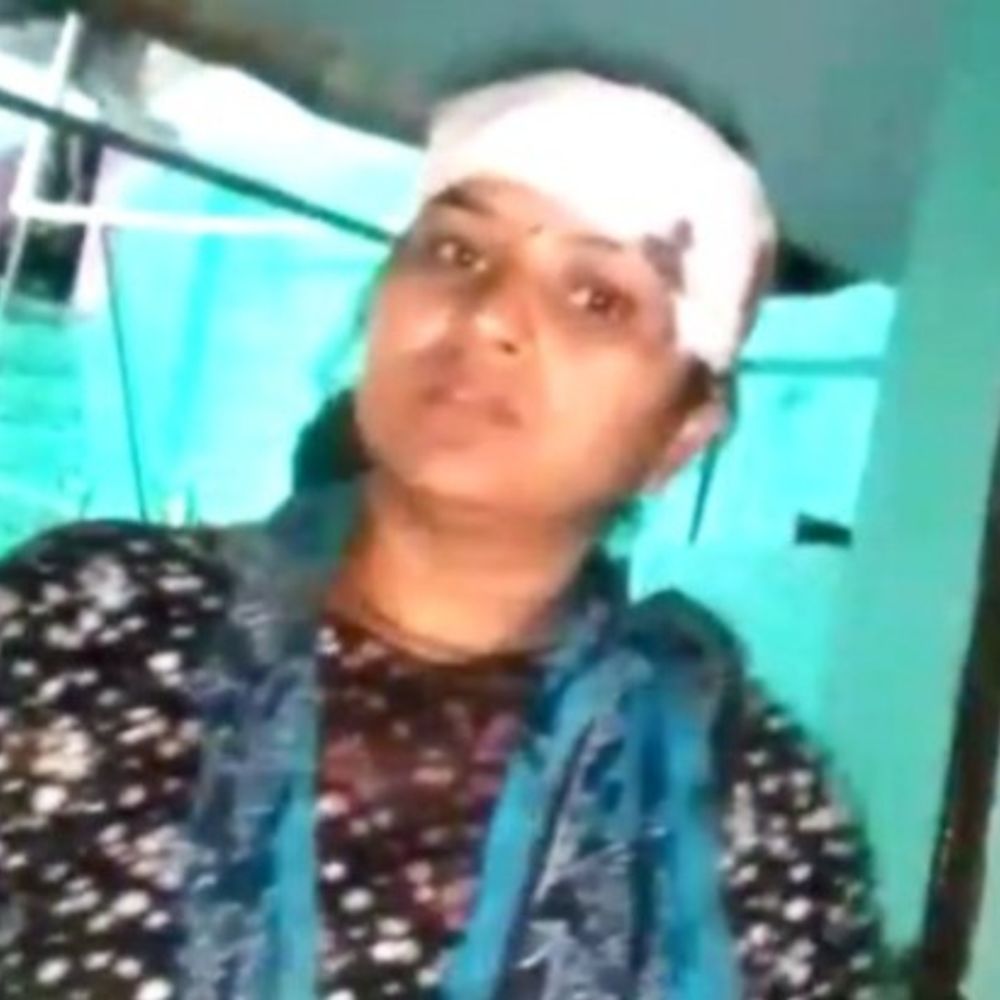 मेरठ में पुरानी रंजिश में घर पर हमला:पथराव में युवती समेत दो लोग घायल, एसएसपी से शिकायत