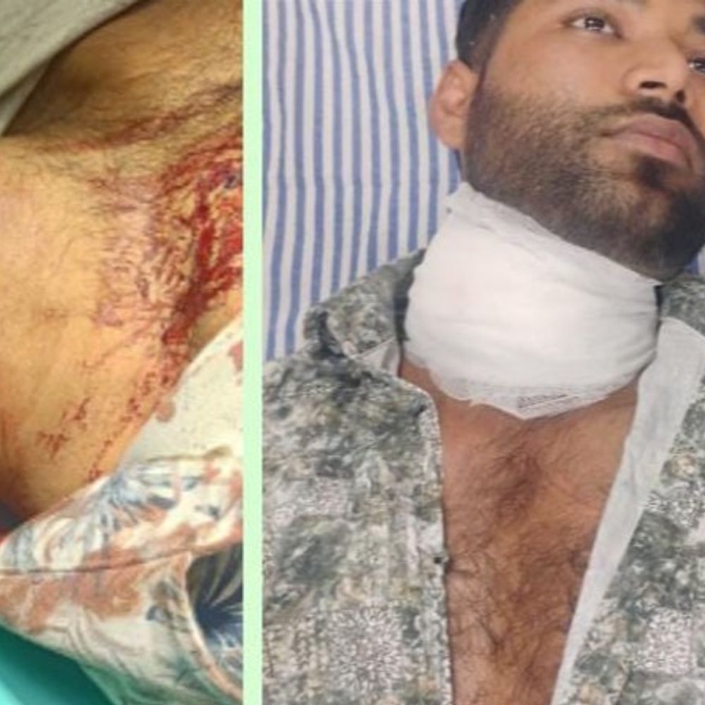 शादी से पहले युवक की गर्दन कटी, बाल बाल बचा:प्रयागराज में रोक के बावजूद चाइनीज मंझे का इस्तेमाल, जान बचाने को 8 टांके लगाने पड़े