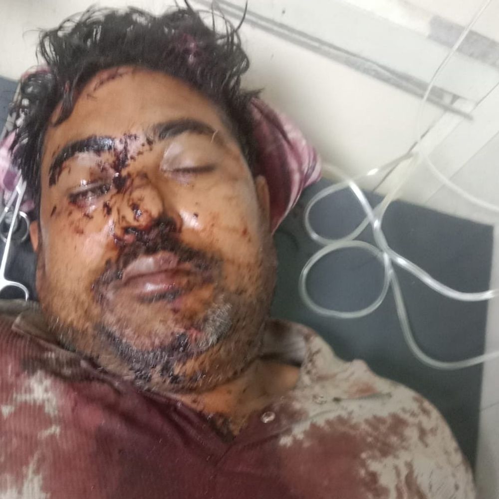 पानीपत में दुकान के एडवांस किराया पर खूनी संघर्ष:  दुकानदार पर चाकूओं से किया हमला, सिर और गर्दन पर आई गंभीर चोटें – Panipat News