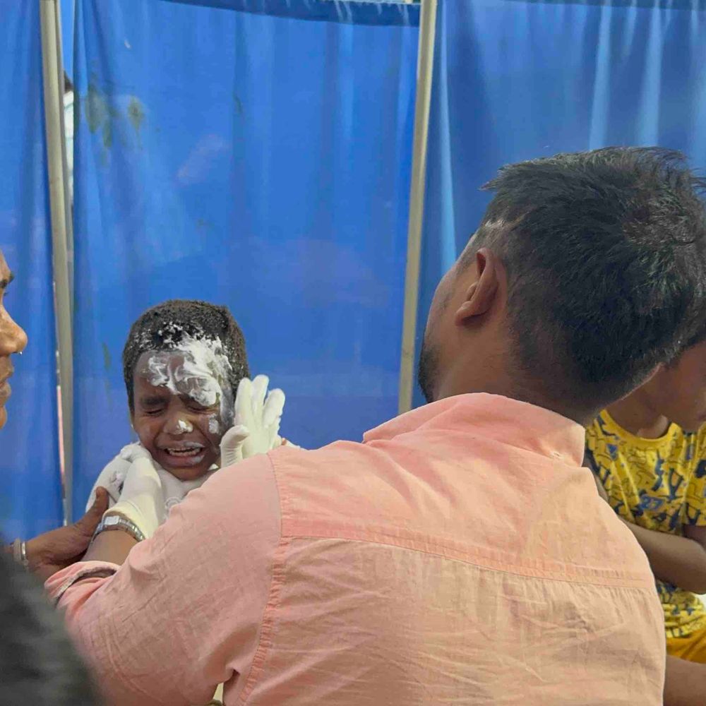 कानपुर में कूड़े के पटाखे से दो बच्चे झुलसे:ज्वलनशील पाउडर जलाने से हुआ धमाका, उर्सुला रेफर