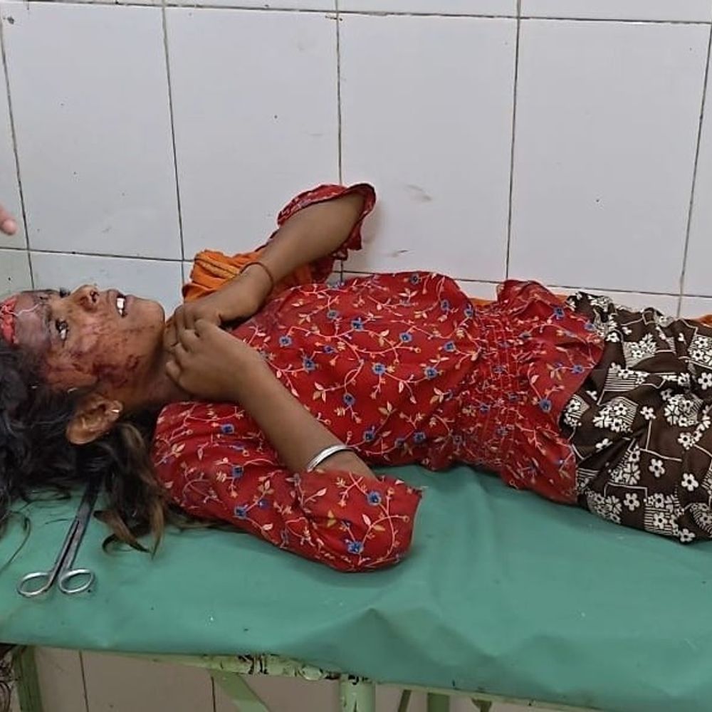 ललितपुर में थ्रेसर की चपेट में आई किशोरी:दुपट्टा फंसने से गंभीर घायल, झांसी मेडिकल कॉलेज रेफर