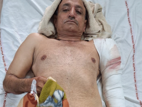 झज्जर में दिल्ली पुलिस के रिटायर्ड हेड कॉन्स्टेबल पर फायरिंग:क्लर्क बेटे ने कंधे-जांघ पर गोलियां मारीं; 18 करोड़ रुपए की प्रॉपर्टी का विवाद