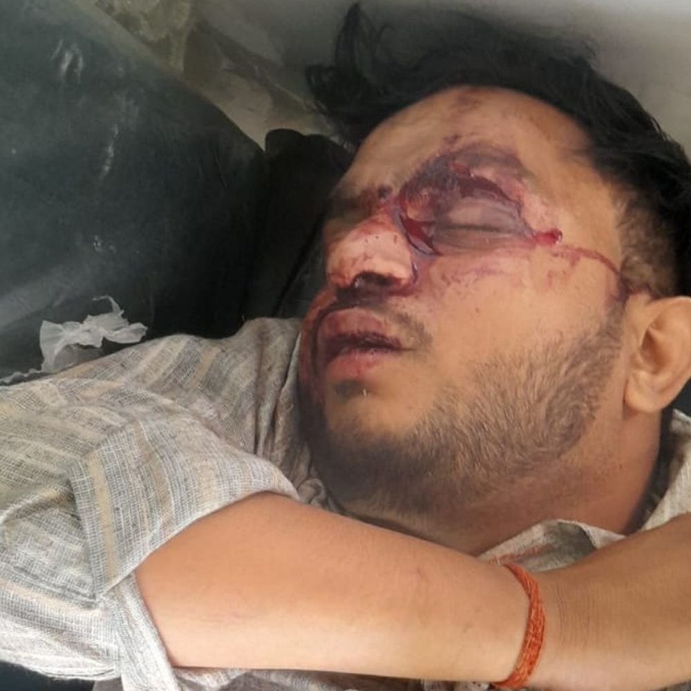 प्रतापगढ़ सड़क हदासे में 2 की मौत, 3 गंभीर घायल:बाघराय के पास दो बाइक की आमने-सामने भीड़त, वाहन क्षतिग्रस्त