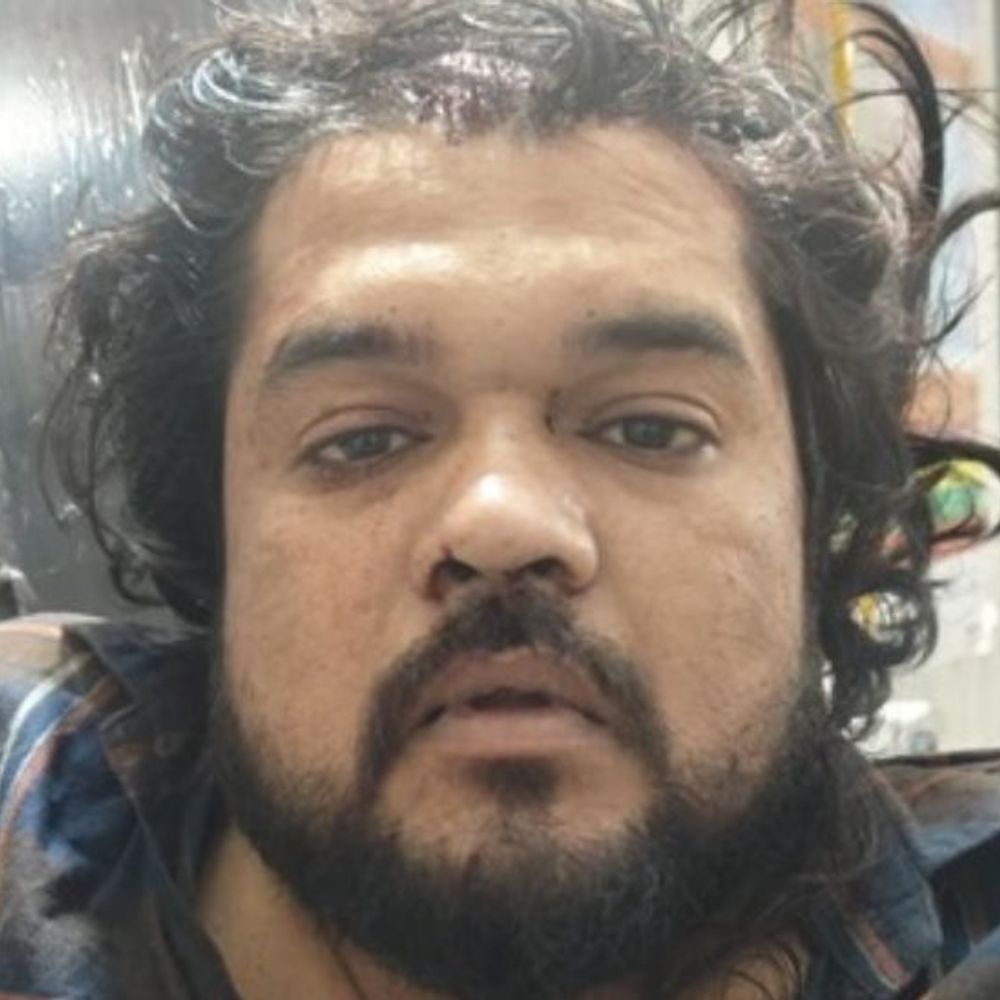 दंपति से लूट करने वाला बदमाश गिरफ्तार, फरार की तलाश:रेलवे रोड के जैन नगर के पास दंपति से लूटपाट कर हो गए थे फरार