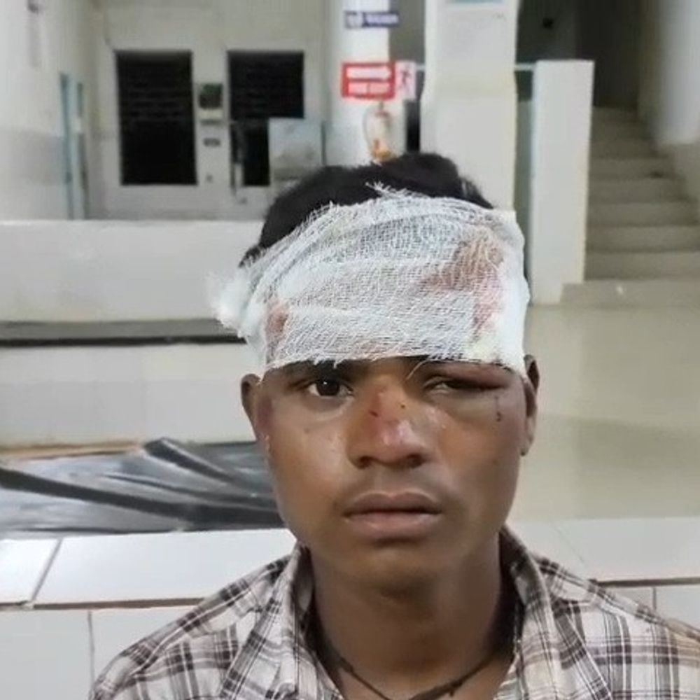 बाइक फिसलने से चाचा की मौत, भतीजा घायल:रास्ता भटकने के बाद बाइक फिसलने से हादसा; दोनों रिश्तेदारी में जा रहे थे