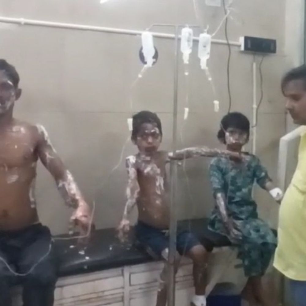 गैस सिलेंडर में लगी आग , तीन लोग झुलसे:पिता, पुत्र और पुत्री बहराइच जिला अस्पताल में भर्ती, लीकेज से लगी आग