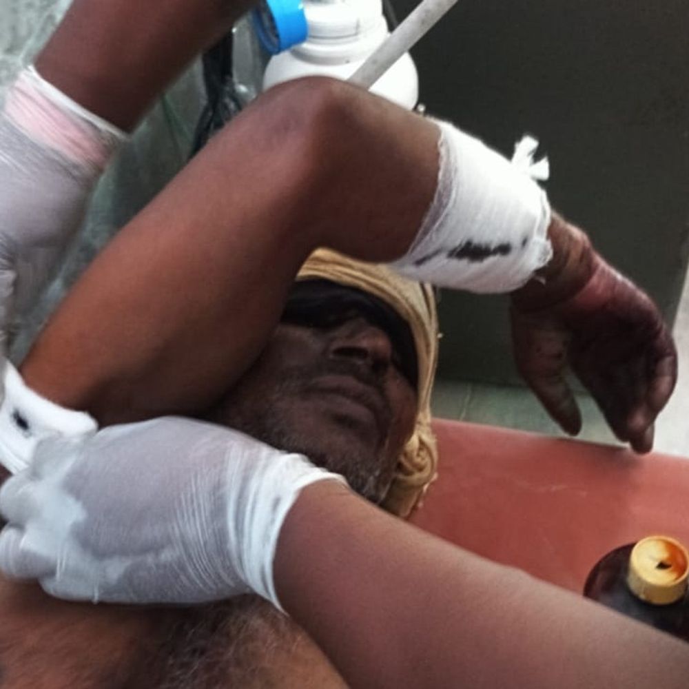 गन्ने की छिलाई करते समय किसान पर बाघ का हमला:गंभीर रूप से घायल, ग्रामीणों के शोर मचाने पर छोड़कर जंगल की ओर भागा