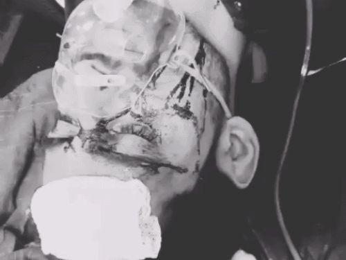 चंडीगढ़ में कार ने ऑटो को मारी टक्कर:  100 मीटर तक घसीटा, चालक गाड़ी छोड़कर फरार, एलांते में जा रहा था सप्लाई देने – Chandigarh News