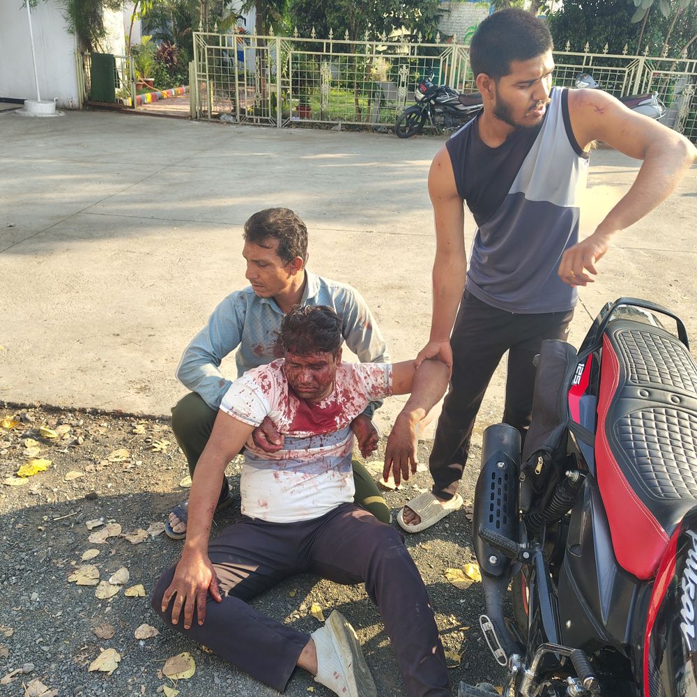 भाजपा नेता का सिर फोड़ा, हालत गंभीर:अतिक्रमण विवाद में कार्रवाई करने पर कुल्हाड़ी-लाठियों से पीटा; मंत्री पर हमले का आरोप