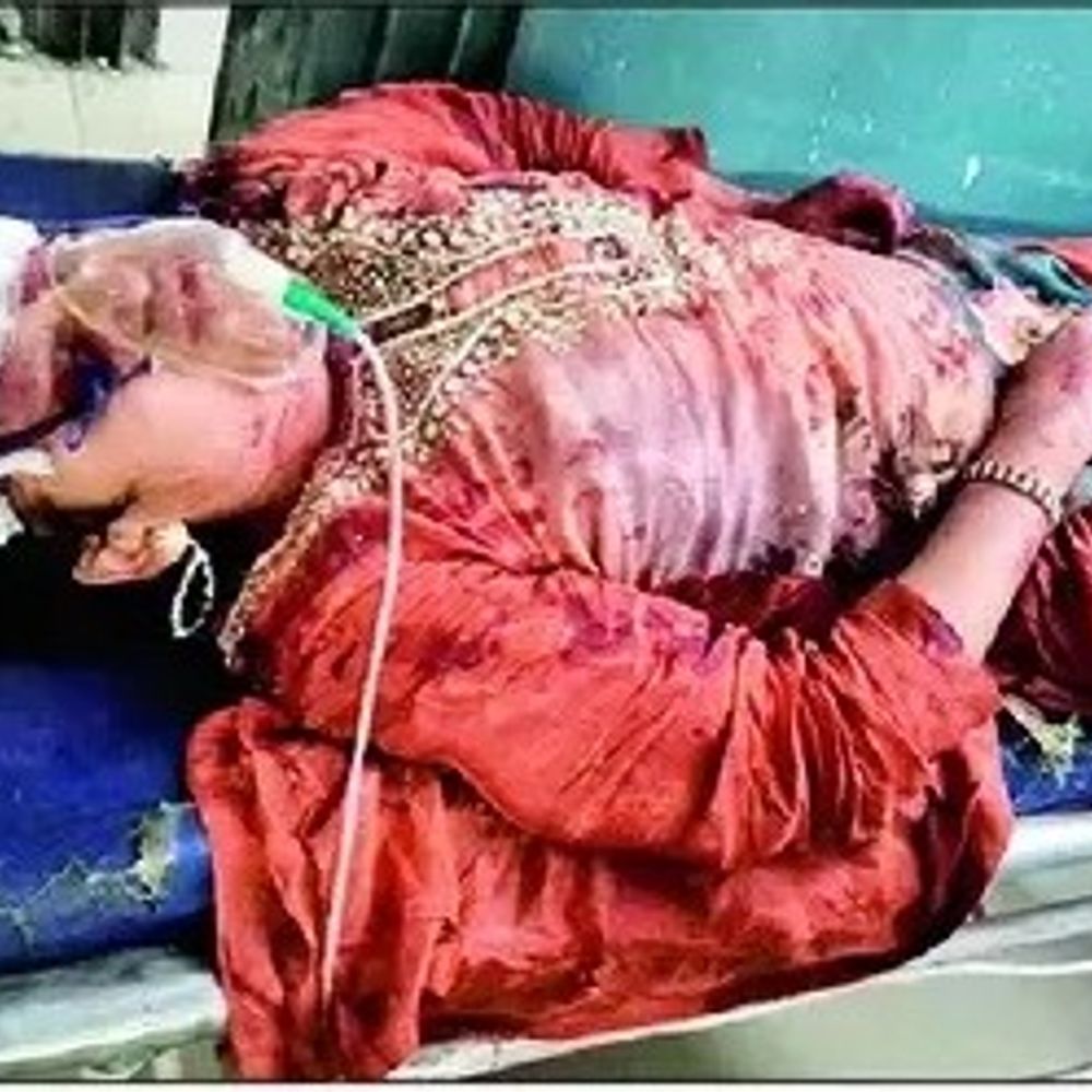 मुरादाबाद में एक्सीडेंट में एक की मौत, 7 घायल:शादी में शामिल होकर ऑटो से लौट रहे थे, बोलेरो ने मारी टक्कर