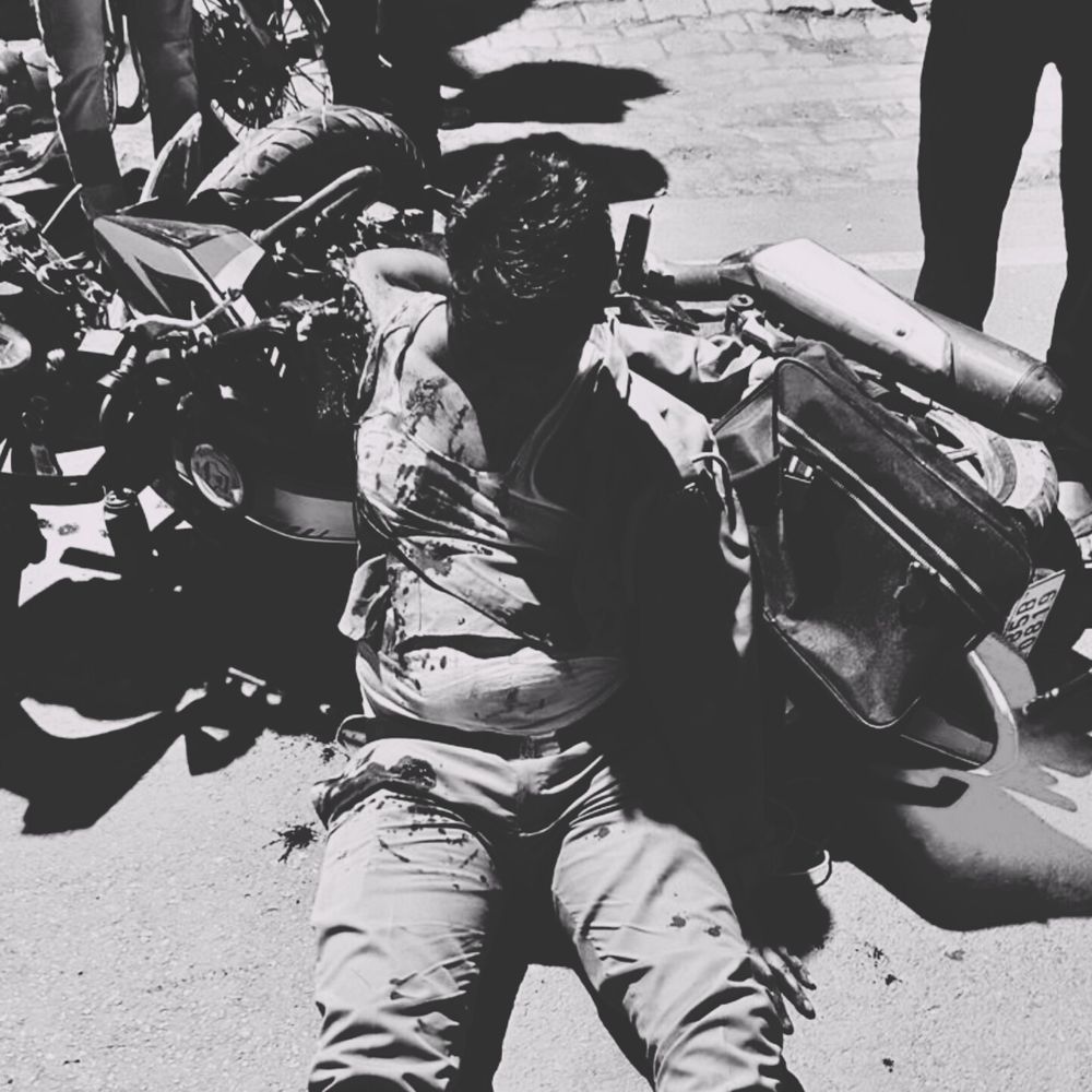 इटावा में जीआरपी सिपाही गंभीर घायल:ड्यूटी के दौरान अज्ञात वाहन ने मारी टक्कर, हायर सेंटर रेफर