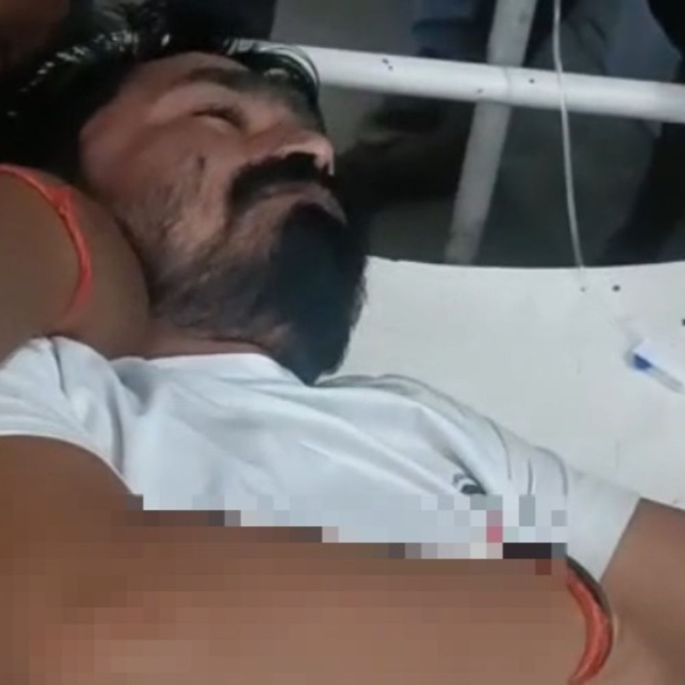 चुनावी रंजिश में युवक पर चाकू से हमला:जौनपुर में पेट में चाकू घोंपा, हालत गंभीर