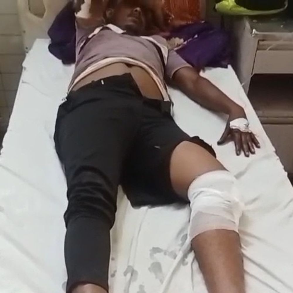 जीआरपी सिपाही को धक्का देने वाला आरोपी को जेल भेजा:पुलिस हिरासत से भागते समय सिपाही का पैर कटा था