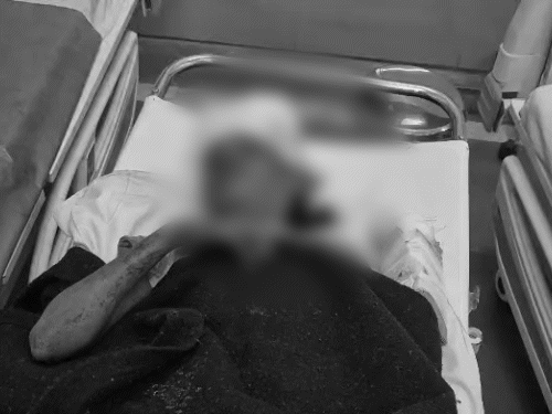 तलवार से महिला का काटा गला, आंख निकाली:पत्नी से अफेयर के शक में परिवार पर हमला, पोती बोली- जो सामने आया उसे मारा