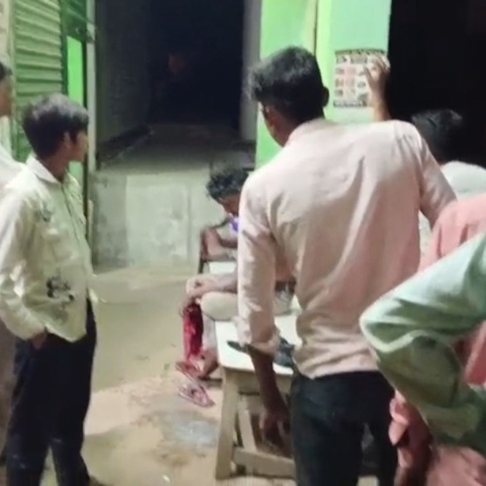 संभल में इनवर्टर बैटरी फटी, मिठाई दुकानदार झुलसा:तेजाब से गंभीर घायल, शुरुआती इलाज के बाद भी राहत नहीं