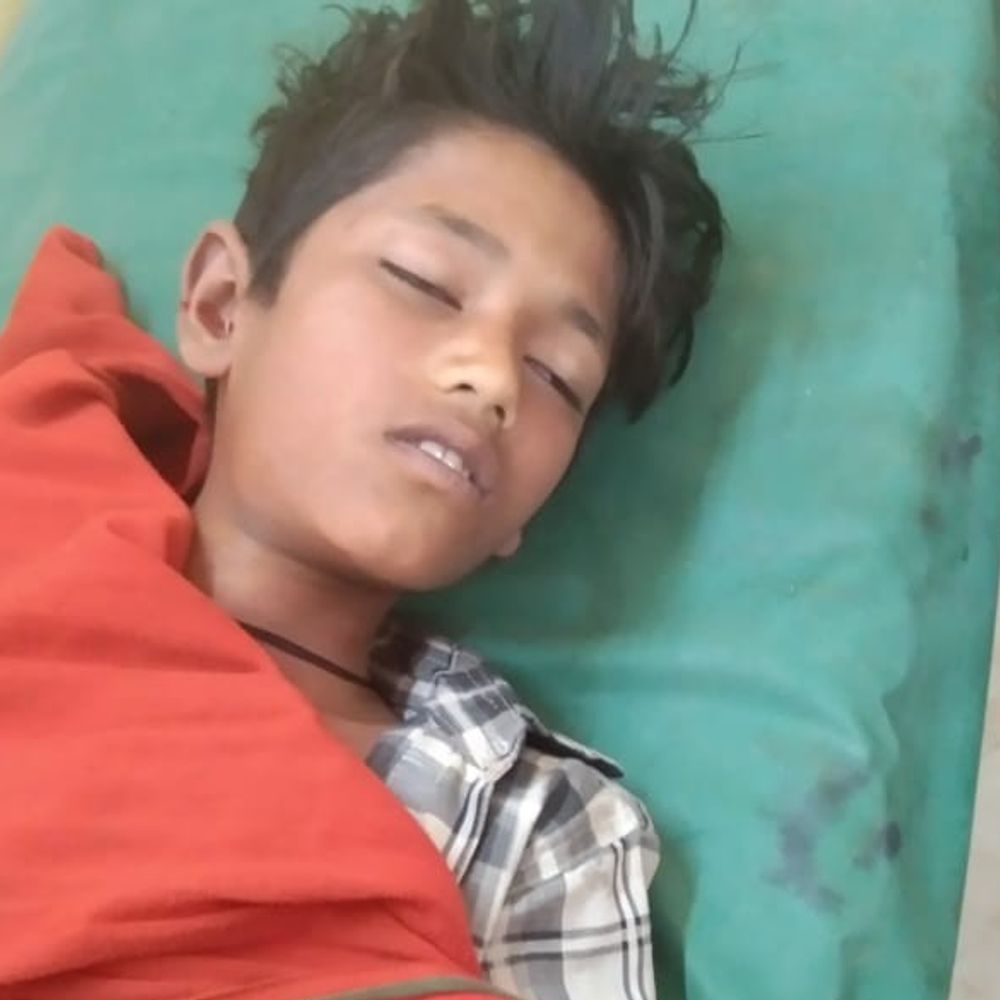 आकाशीय बिजली गिरने से दो बच्चों समेत तीन की मौत:2 बच्चे गंभीर रूप से झुलसे, घर के बाहर काम कर रही महिला पर गिरी बिजली