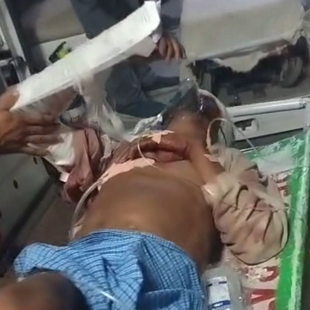 जालौन में वृद्ध पर जानलेवा हमला:लाठियों से पीटकर अधमरा किया, फिर सीने पर चढ़ा दी कार