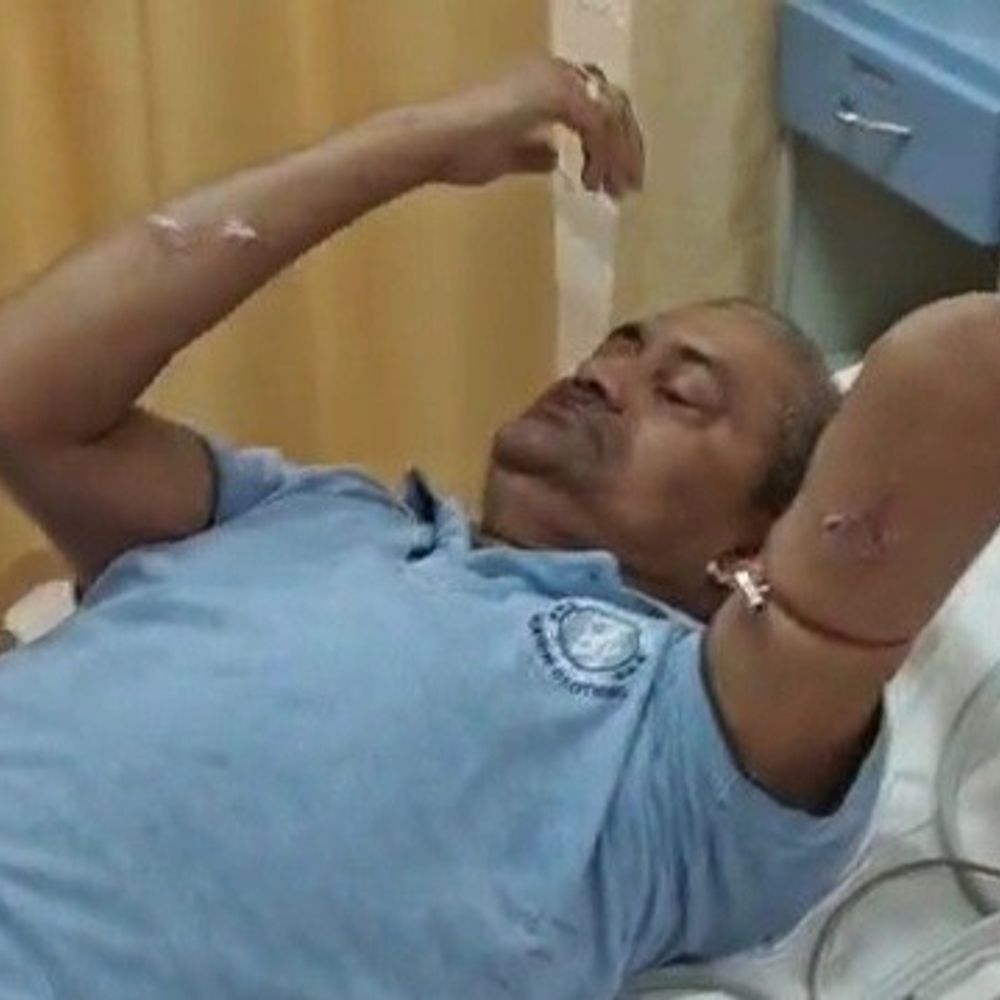 रक्षा मंत्रालय के पूर्व अधिकारी पर कुत्ते ने किया अटैक:नोएडा में 13 जगह काटा, पत्नी के साथ सोसाइटी में टहल रहे थे; शोर मचाने पर लोगों ने बचाया