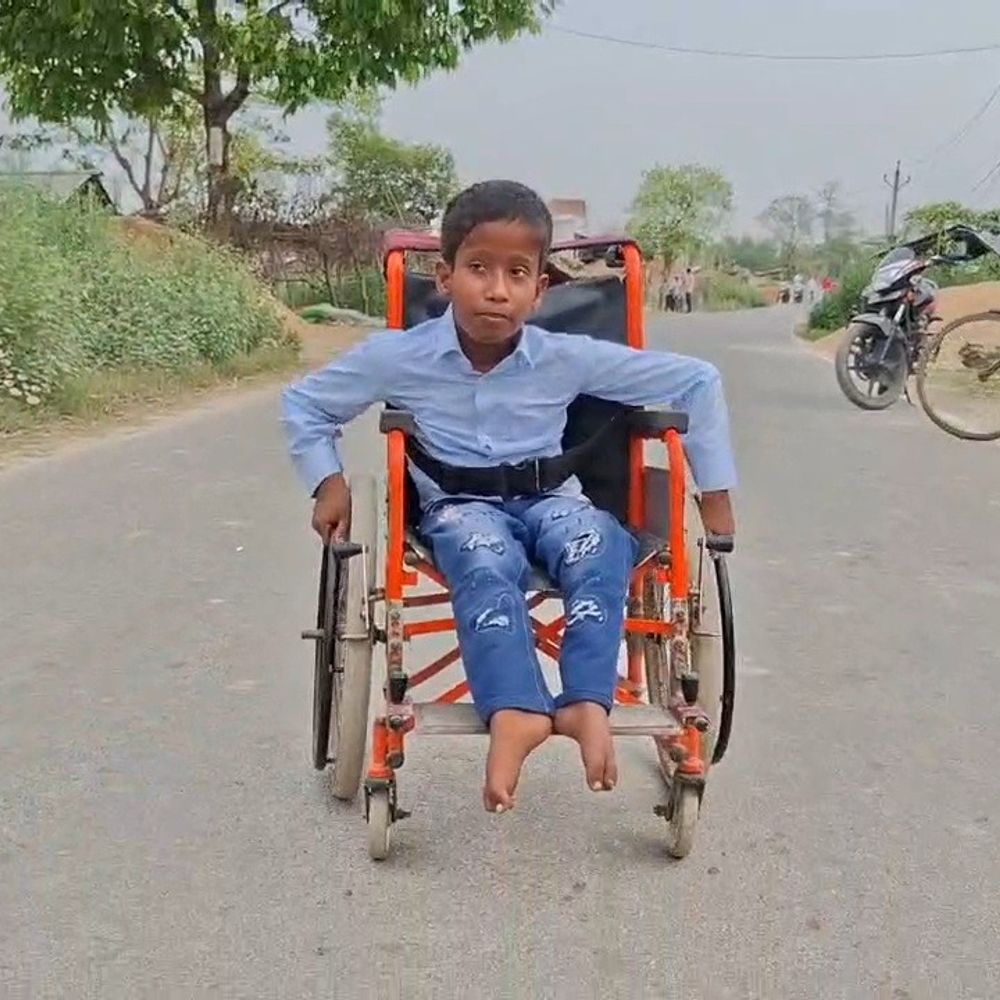 नवोदय में 82 अंक, दिव्यांग छात्र को दाखिले से इनकार:कुशीनगर डीएम बोले- बच्चे का नुकसान नहीं होगा, टॉप 20 छात्रों में बनाई जगह