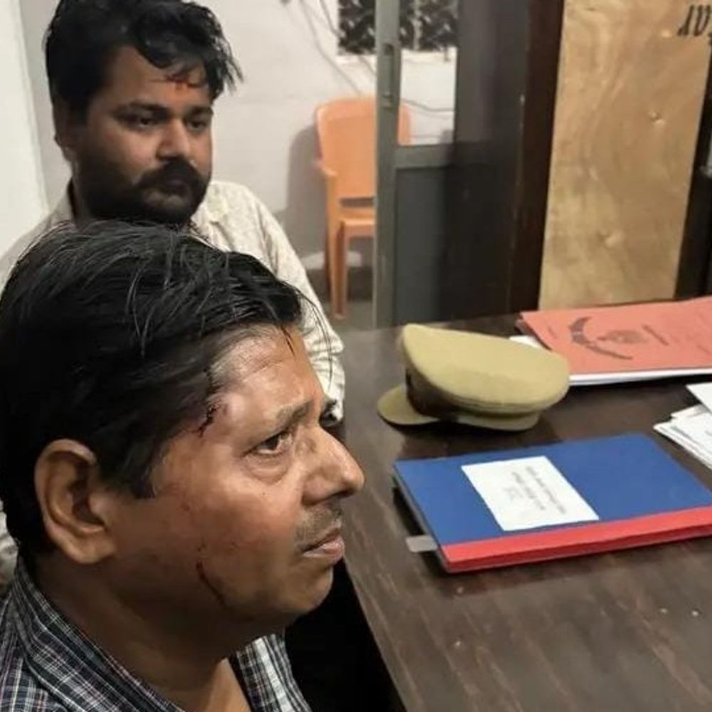 हरदोई में सर्राफा व्यापारी पर हमला:बदमाशों ने तमंचे की बट मारकर जेवरात से भरा बैग लूटा