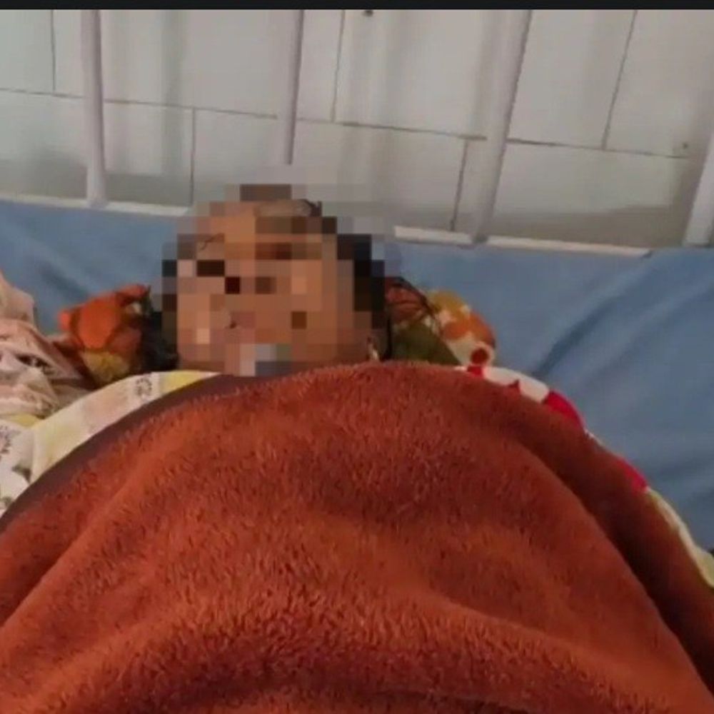 एसिड हमले के आरोपी बाप-बेटों की जमानत खारिज:सत्र न्यायालय ने 15 दिन पुराने मामले में सुनाया फैसला