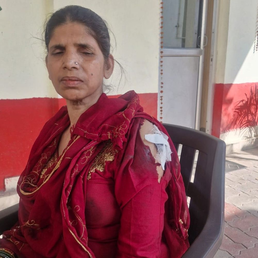 लखनऊ में घर में घुसकर जानलेवा हमला:चाकू मारकर महिला की चेन लूटी, मामूली विवाद से शुरू हुआ बवाल