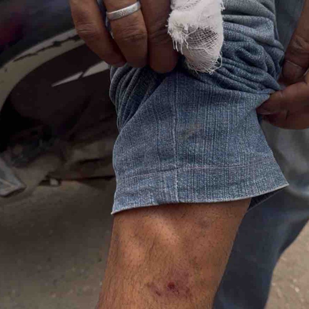 स्कूटी से टक्कर के बाद चमड़ा व्यापारी पर हमला:कानपुर में लाठी-डंडों से पीटा, कार में तोड़फोड़ की