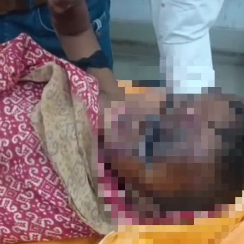 देवरिया में चूल्हे पर गिरा मासूम, गंभीर रूप से झुलसा:गैस खत्म हो गई थी, मिट्‌टी के चूल्हे पर बन रहा था खाना