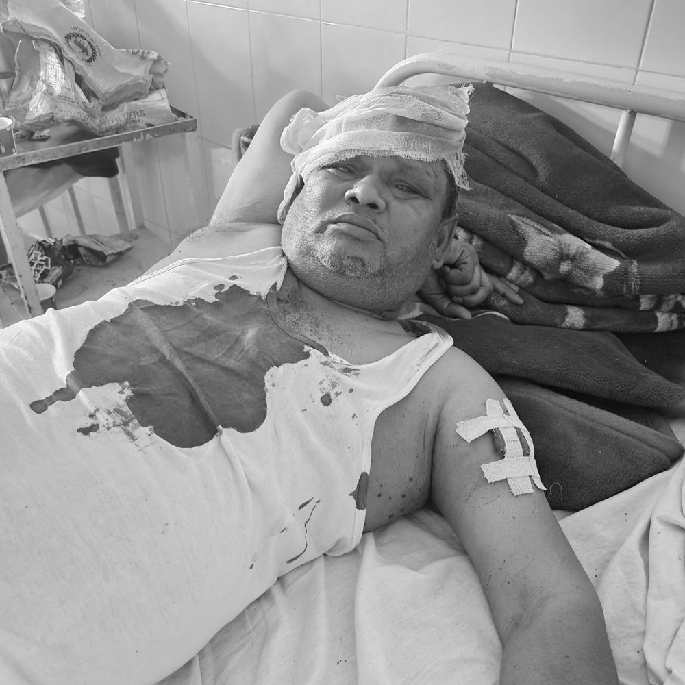 अबोहर में दुकानदार पर हमला:  घर लौटते समय 3 नकाबपोश युवकों ने घेरा था, पुलिस मामले की जांच में जुटी – Abohar News