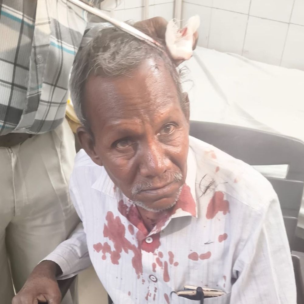 रावतपुर में पैसे के विवाद पर मारपीट, VIDEO:दोनों पक्षों में चले लाठी-डंडे, पुलिस थाने लाई