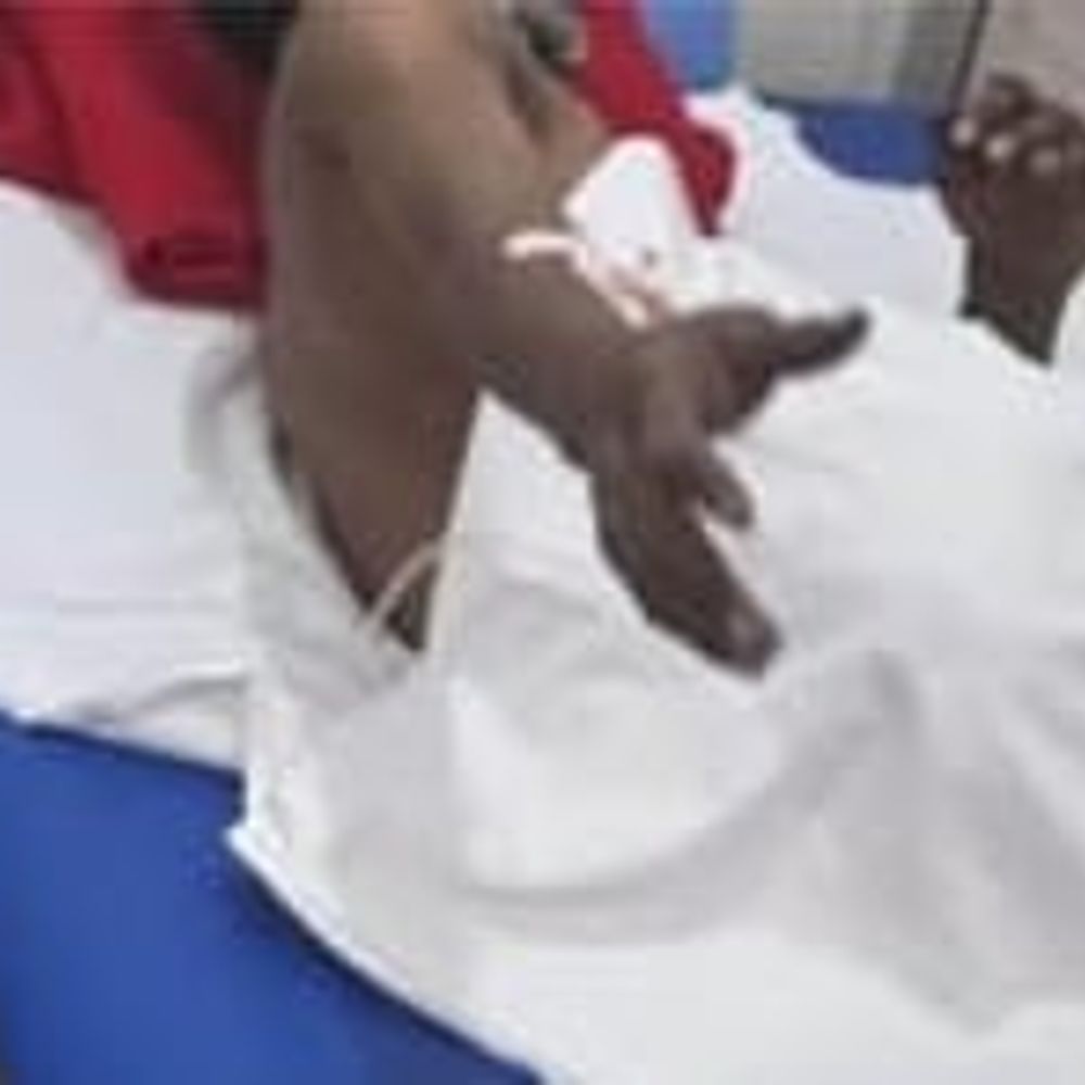 प्रेमी साथ मिलकर पत्नी ने काट दिया पति का गुप्तांग:अवैध संबंध का किया था विरोध, अस्पताल में भर्ती, पुलिस जांच में जुटी