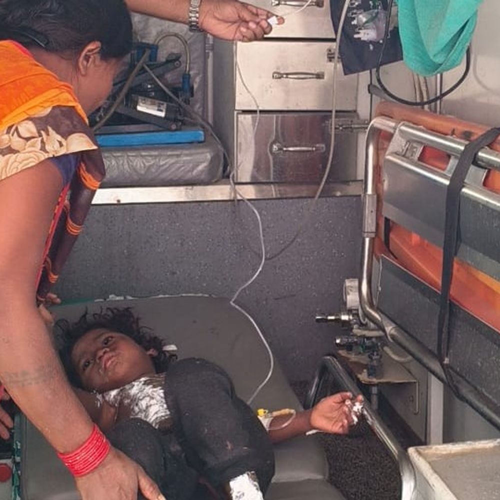 सोनभद्र में बिजली पोल के स्टे-वायर में उतरा करंट:मां समेत दो मासूम बच्चे झुलसे, एक की हालत गंभीर; वाराणसी रेफर