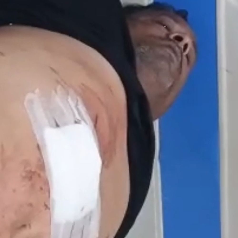 कल्याणपुर में प्रॉपर्टी डीलर पर चाकू से हमला:पैसे के विवाद में अधिवक्ता पर आरोप, पुलिस जांच में जुटी