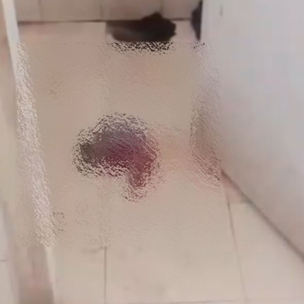 उन्नाव जिला अस्पताल के बाथरूम में मिला भ्रूण:इमरजेंसी वार्ड में सफाई के दौरान हुई घटना, पुलिस ने जांच शुरू की