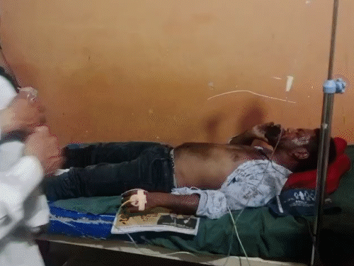 बिलासपुर में AC कंप्रेसर फटने से ब्लास्ट:2 भाई बुरी तरह झुलसे, दुकान में मरम्मत के दौरान कंप्रेसर ब्लास्ट की आशंका