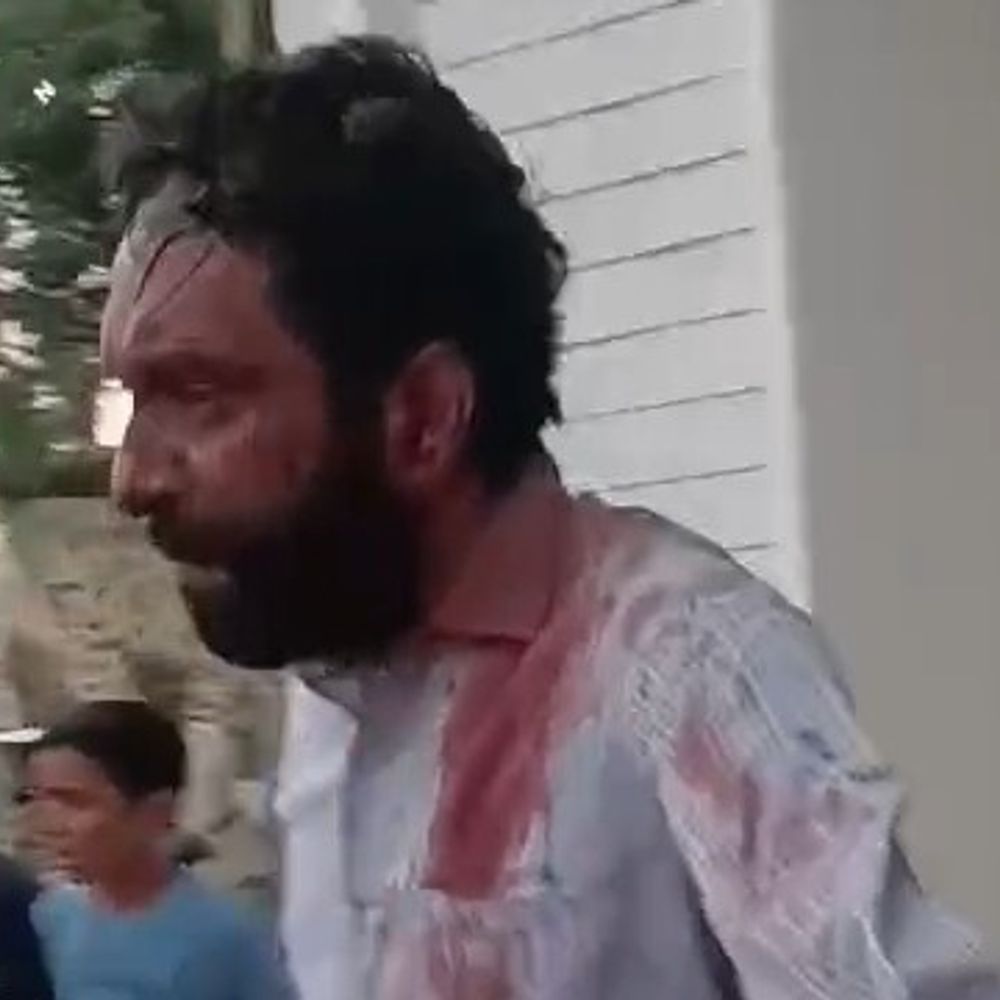 
                 कमेंट करने पर अम्हेडा साहनी गांव में लाठी-डंडे चले:मारपीट का वीडियो वायरल करने पर युवक पर केस, दोनों पक्षों पर भी मुकदमा 
            