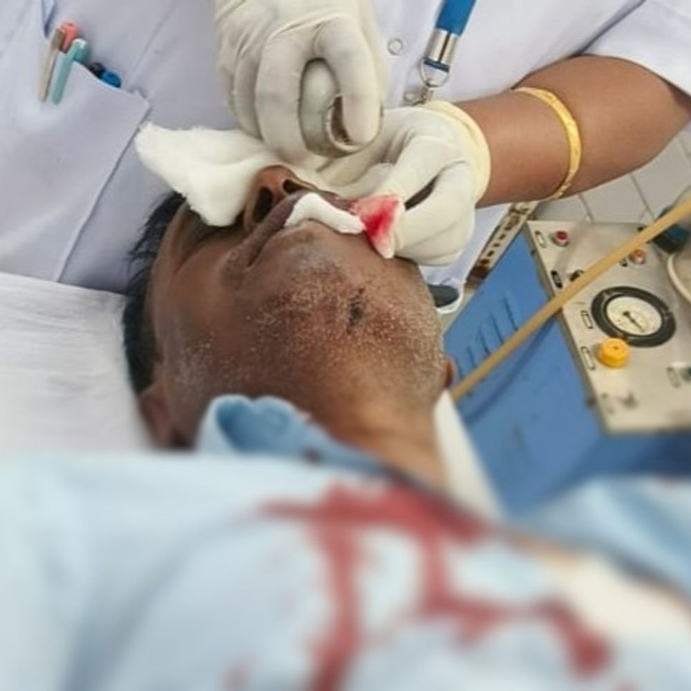 एसईसीएल मैनेजर पर ग्रामीणों का हमला, गंभीर घायल:  सूरजपुर में सड़क निर्माण के विरोध में हुई ज़ोरदार पत्थरबाजी – Surajpur News